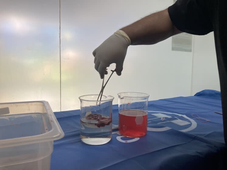 A flotation test is performed at Mexico City's Institute of Forensic Science. In this case, the lungs float.