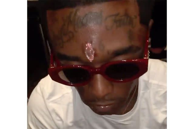 Lil Uzi Vert/Instagram Lil Uzi Vert reveals the pink diamond inserted into their forehead