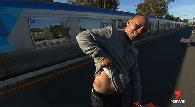 Mr Luc suffered a concussion and heavy bruising to his hip. Photo: 7 News