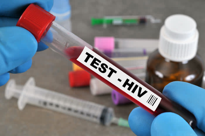 Test VIH