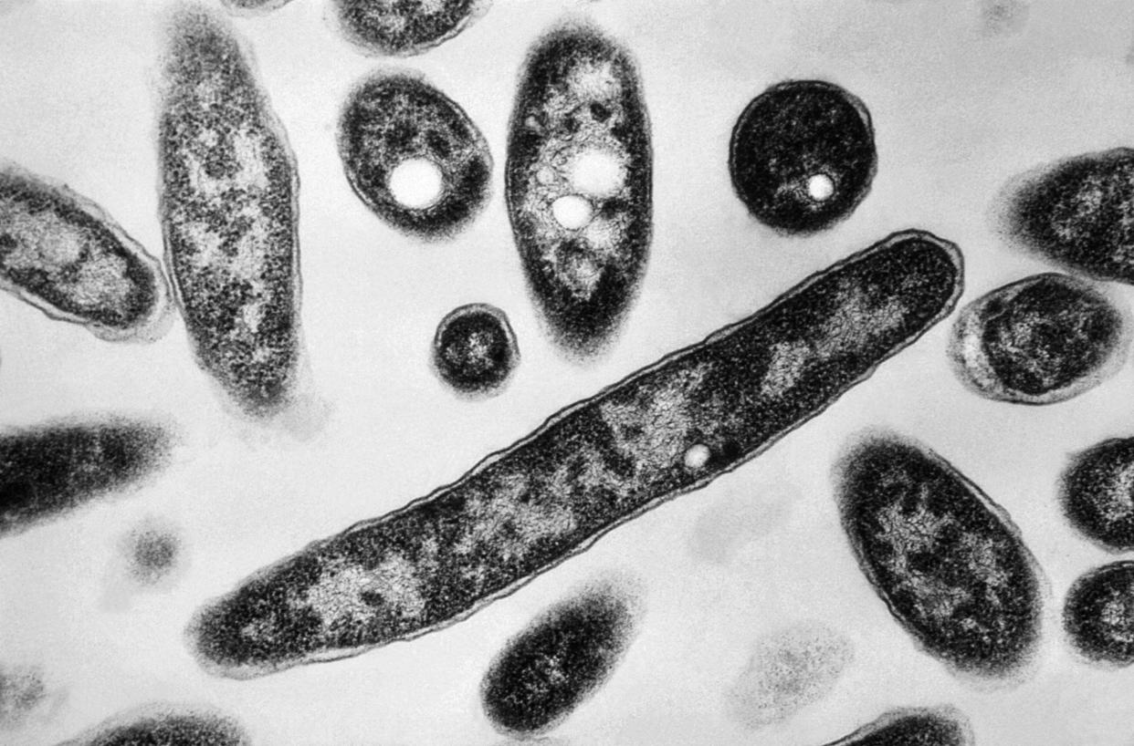 Una foto sin fecha proporcionada por los Centros para el Control y la Prevención de Enfermedades muestra a la bacteria responsable de causar la enfermedad del legionario (Francis Chandler/Centros para el Control y la Prevención de Enfermedades vía The New York Times).