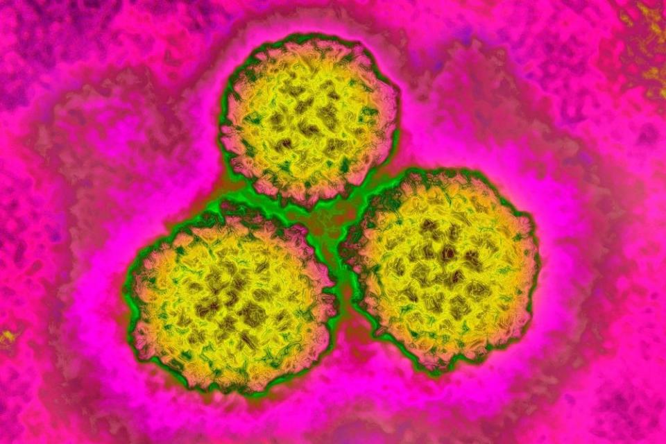 HPV strain | BSIP/Universal Images Group via Getty