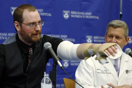 Will Lautzenheiser (L) demonstrates some of the motion in his left arm as Dr. Matthew Carty, a member of his transplant team, looks on at a news conference to announce Lautzenheiser's successful double arm transplant at Brigham and Women's Hospital in Boston, Massachusetts November 25, 2014. REUTERS/Brian Snyder