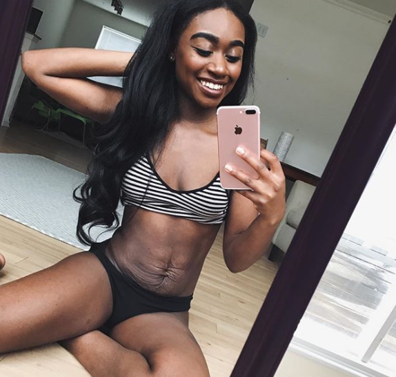 The mum has sparked a body love movement after deciding to embrace her post-baby body. Photo: Instagram