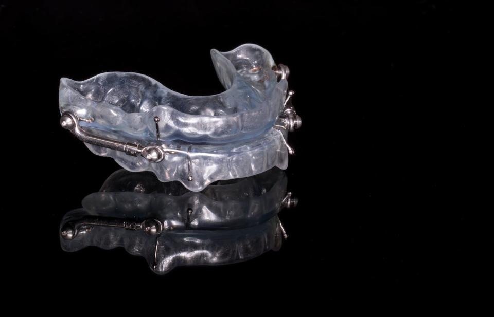 Un dispositivo de avance mandibular (DAM).