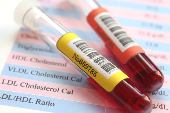 Blood sample vials on a paper with cholesterol lab results.