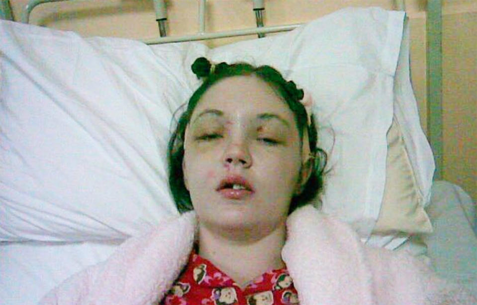 Grainne Kealy was 22 years old when she broke every bone in her face and was left “unrecognisable” after riding in the passenger seat of her boyfriend’s jeep that crashed. Source: Gráinne Kealy/Facebook