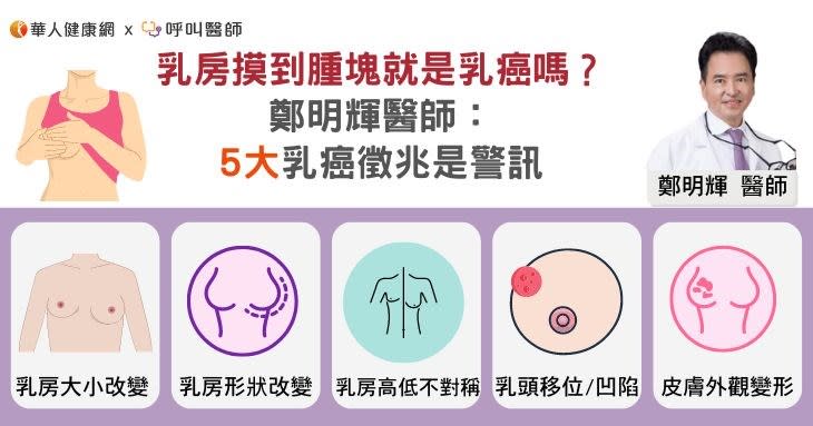 乳房摸到腫塊就是乳癌嗎？鄭明輝醫師：5大乳癌徵兆是警訊