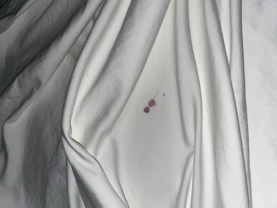 Bloodstain on the sheets.