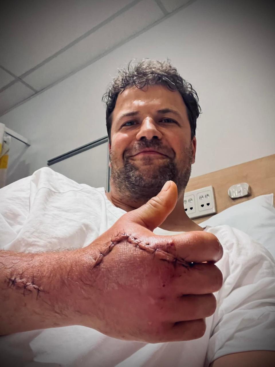 Alexey Barkhatov looking at the camera and smiling thumbs up showing lacerations and thick stitches on his hand due to the accident in Sydney Harbour..