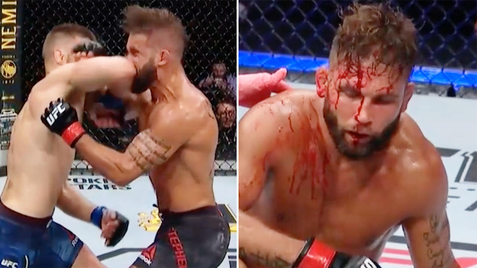 Pictured here, Jeremy Stephens is left with blood pouring from his face after a second round TKO against Calvin Kattar.