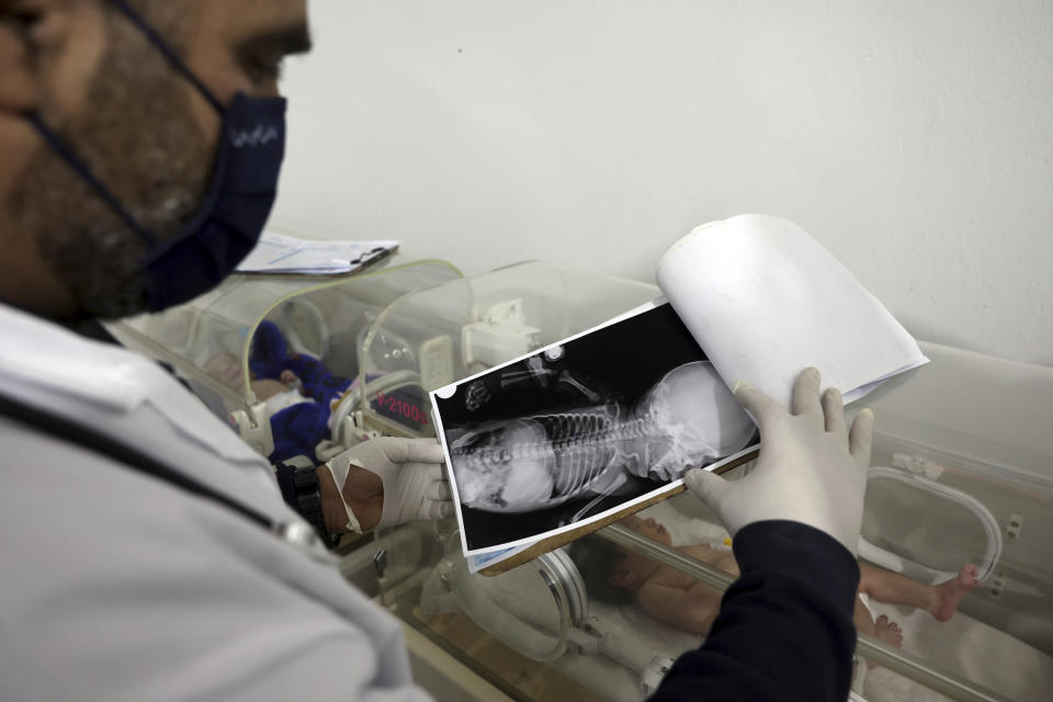 Doctor Hani Maarouf looks at an x-ray of a baby girl who was born under the rubble caused by an earthquake that hit Syria and Turkey, as she lays inside an incubator at a children's hospital in the town of Afrin, Aleppo province, Syria, Thursday, Feb. 9, 2023. The baby girl is the only survivor in her family after her parents and four siblings were killed in Monday's 7.8 magnitude quake that hit southern Turkey and northern Syria. She has been given a name, Aya, Maarouf who is treating her said Thursday. (AP Photo/Ghaith Alsayed)