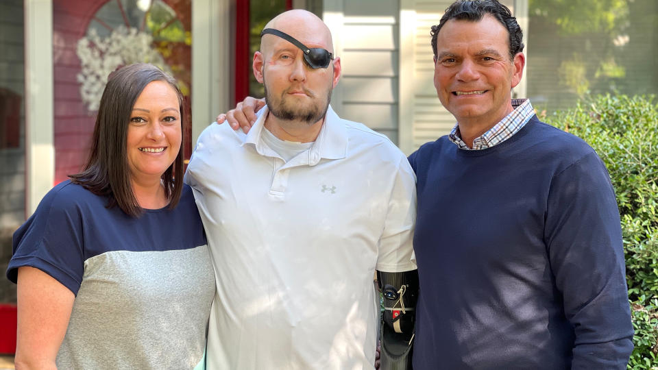 A woman and two men, one with an eye patch, stand together for a group photo