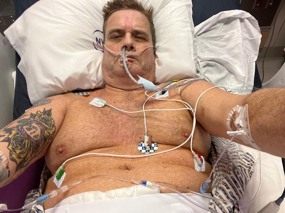 Kevin Kiernan shortly after a kidney was surgically removed from his body in January 2023 to be transplanted to a friend.