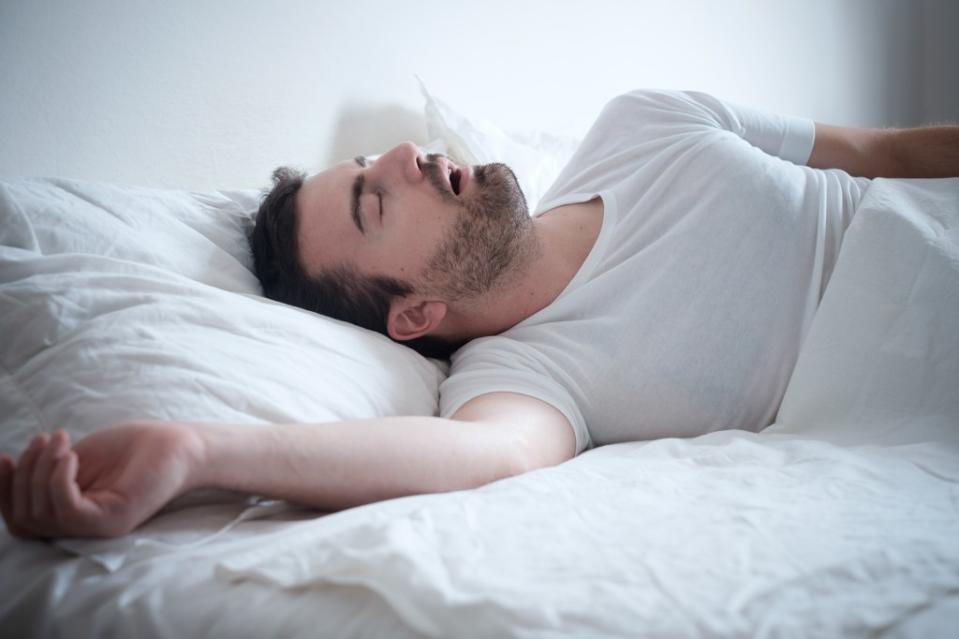 Although sleep apnea can affect anyone, factors such as excessive weight and thicker neck circumference can increase the risk. Getty Images/iStockphoto