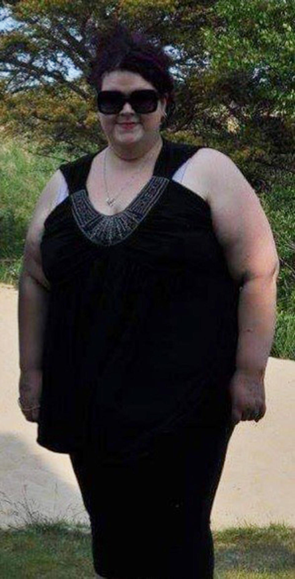 At 550 pounds, Jacki Roberts realized that her weight was holding her back from enjoying life.  (Courtesy Jacki Roberts)