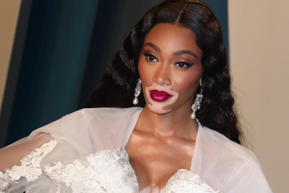 Winnie Harlow. (Photo by Toni Anne Barson/WireImage)