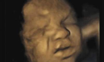 Unborn Babies Can Show Pain In The Womb