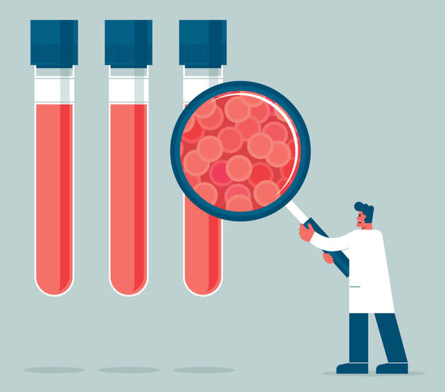 Prueba de sangre para detectar cáncer ofrece esperanza, pero también dudas 