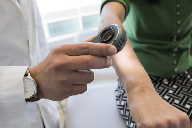 A dermatologist uses a dermatoscope, a type of handheld microscope, to look at skin. Computer scientists at Stanford have created an artificially intelligent diagnosis algorithm for skin cancer that matched the performance of board-certified dermatologists. (Stanford Photo / Matt Young)