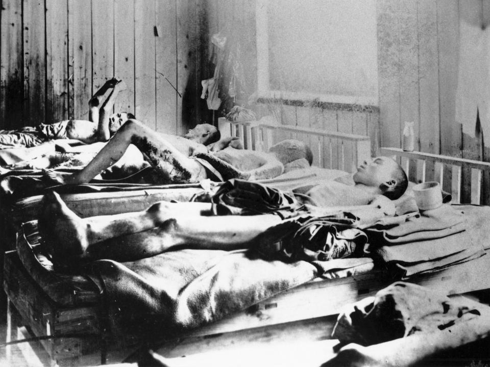 Survivors of the atomic bomb in hospital in 1945.