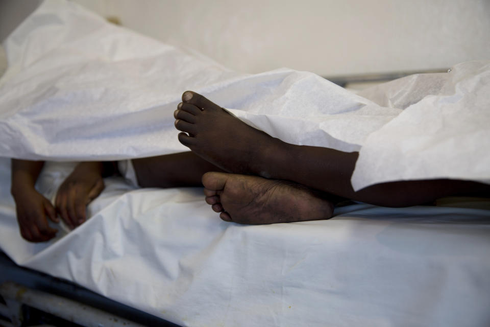 The feet and hands of children who died in a fire at the Orphanage of the Church of Bible Understanding extend beyond the sheet they lie under on a bed at Baptiste Mission Hospital in Kenscoff, on the outskirts of Port-au-Prince, Haiti, Friday, Feb. 14, 2020. A fire swept through a Haitian children's home run by a Pennsylvania-based nonprofit group, killing 13 children. (AP Photo/Dieu Nalio Chery)
