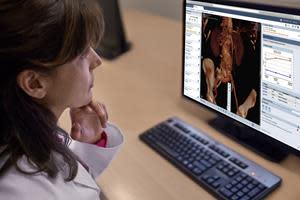 Philips Vue Motion for Radiologists