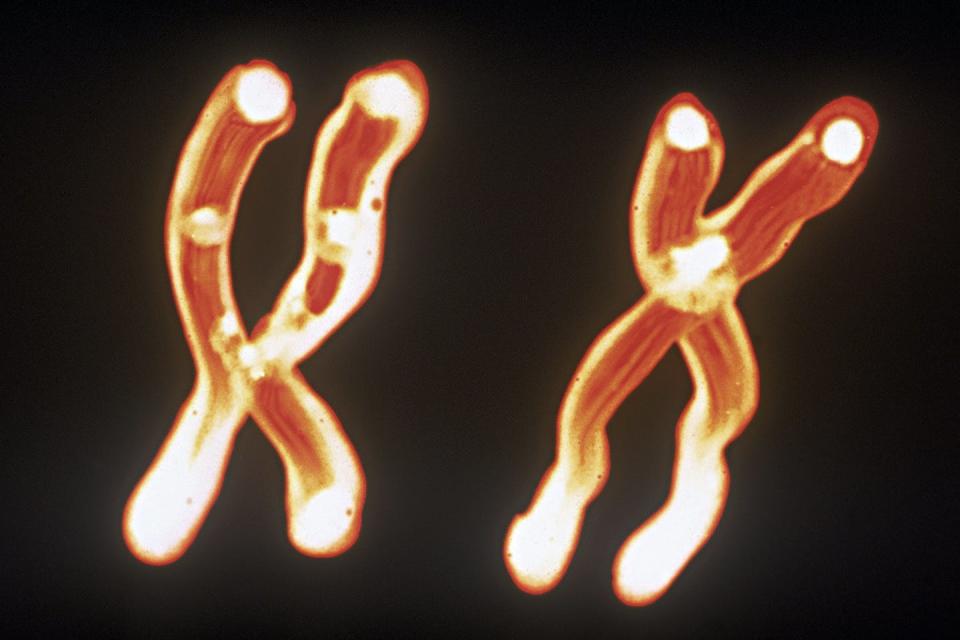 <span>Chromosomes change over time, whether through the process of aging or exposure to harmful substances in the environment.</span> <span><a href="https://www.gettyimages.com/detail/photo/and-y-chromosomes-royalty-free-image/88179880" rel="nofollow noopener" target="_blank" data-ylk="slk:Steven Puetzer/The Image Bank" class="link ">Steven Puetzer/The Image Bank</a></span>