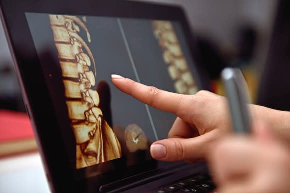 Finger pointing at image of a spine on a laptop screen