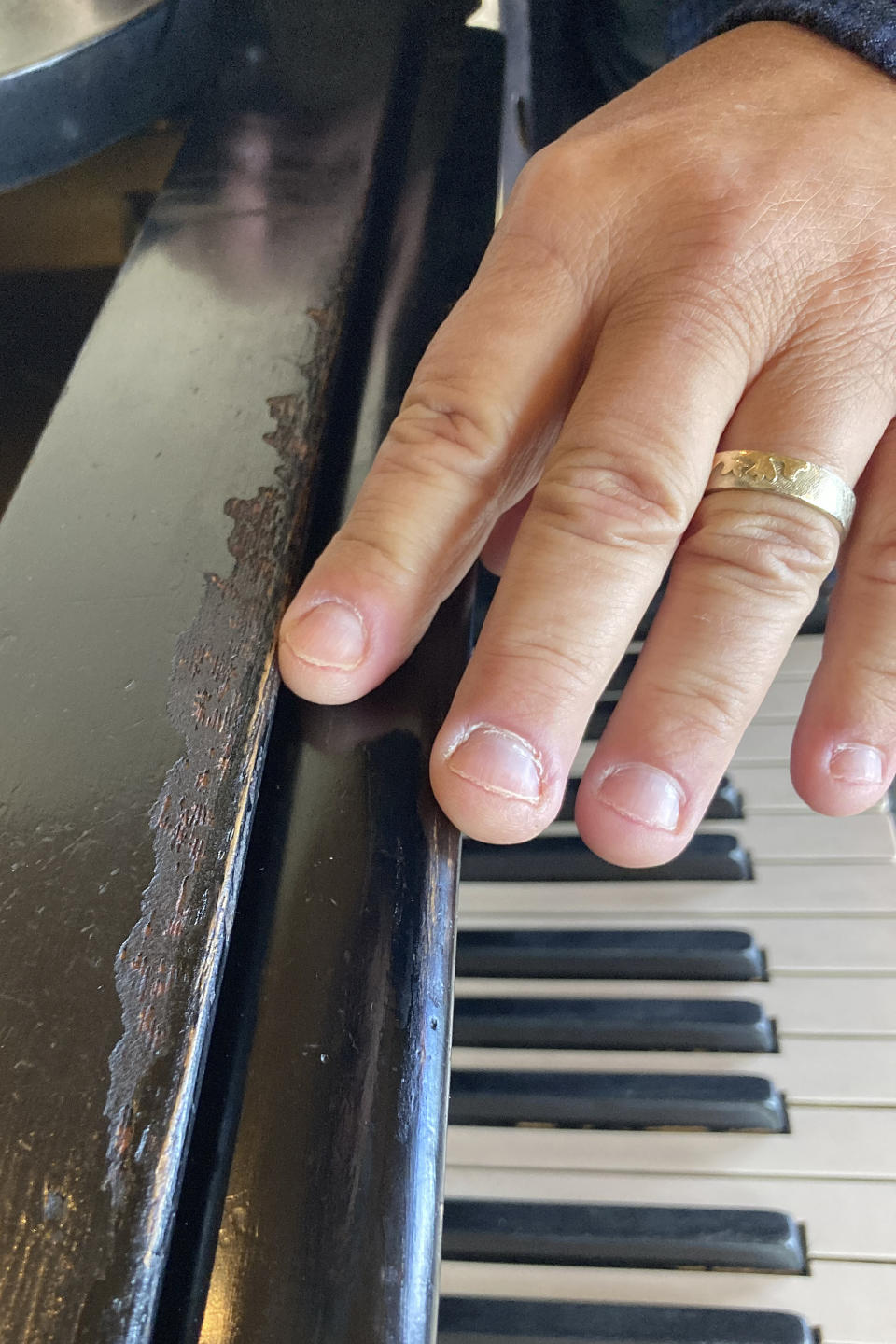 Robert Friedman points out possible bite marks from Thomas Edison on a Steinway grand piano once owned by the inventor, on Sept. 28, 2022, in Woodstock, N.Y. Edison, who was hard of hearing, bit into phonographs and pianos to help him better experience music. Friedman purchased the piano last year and hopes to find a home for it where it can be seen by the public. (AP Photo/Michael Hill)