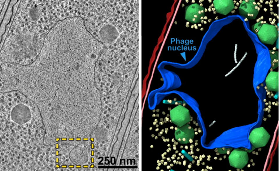 巨噬菌體感染的細菌細胞（左）和藍色（右）輪廓的細胞核樣隔室的顯微照片。（Villa Lab/UCSD）