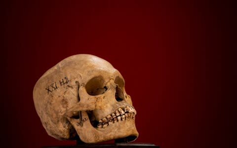 One of the nine human skulls being returned by the University of Edinburgh to their homeland of Sri Lanka after more than 100 years - Credit: SWNS