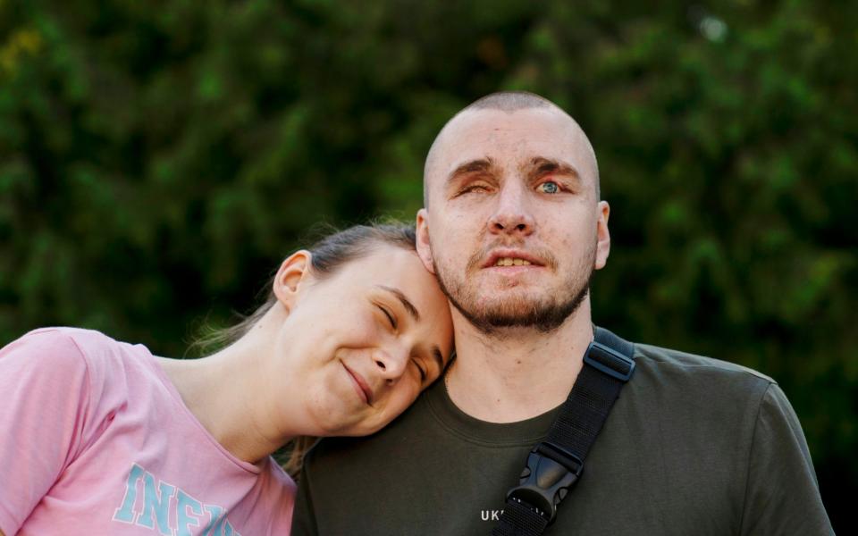 Vlada Ryabets, left, leans on her fiance Ivan Soroka, a 27-year-old former Ukrainian soldier blinded in the war