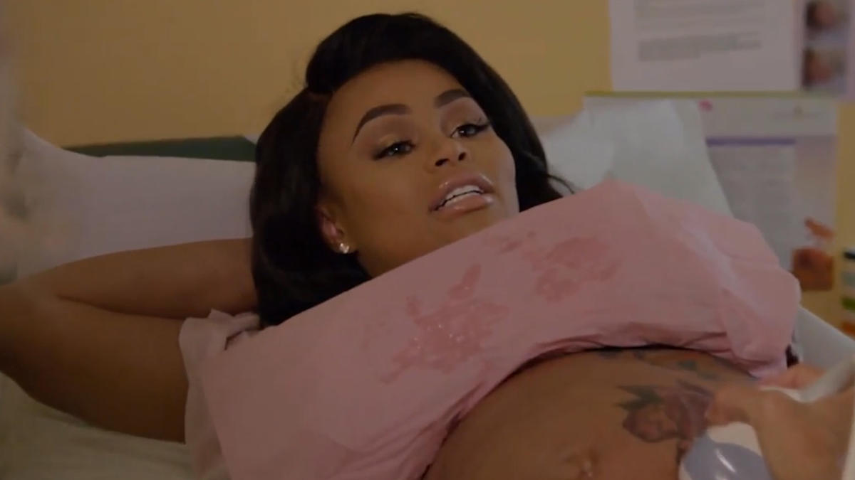 Blac Chyna and Rob Kardashian Already Know the Sex of Their Baby