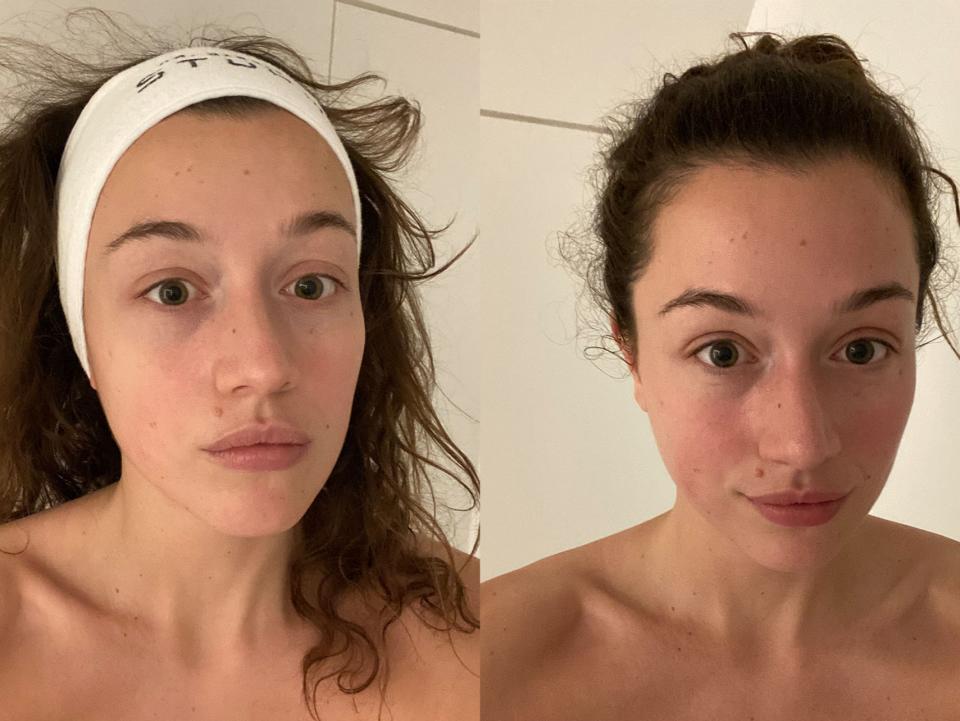 Before (left) and after (right) the treatmentOlivia Petter