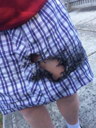 The student was reportedly left with severe burns after her phone exploded in her lap. Photo: Supplied.