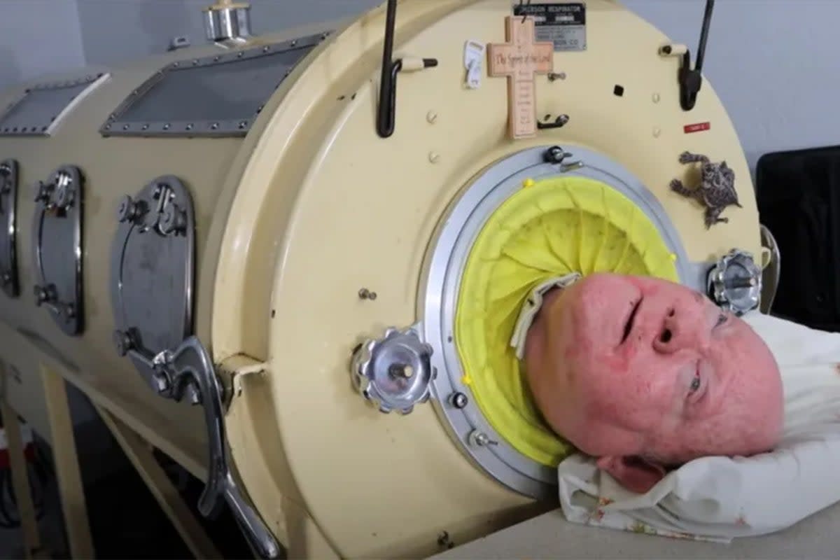 Mr Alexander pictured inside his ‘iron lung’ (YouTube/SBSK)