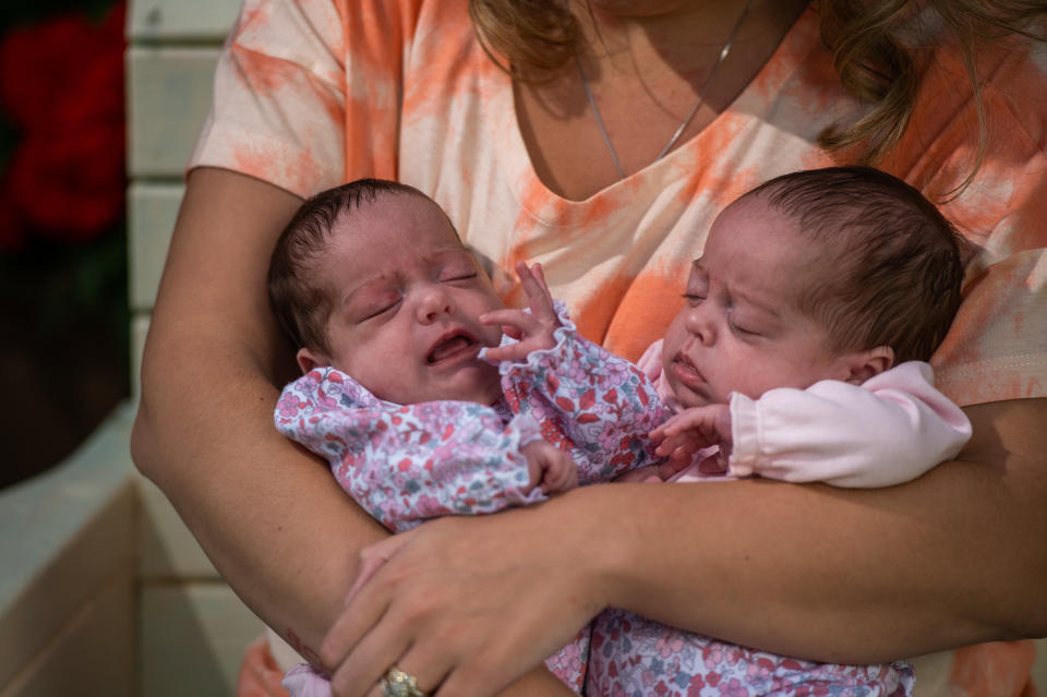 The parents of premature twins thought to be the first in the UK born with Covid-19 have spoken of their joy after they were declared fit and healthy and allowed home. Sarah Curtis, 32, and husband Aaron, 33, were horrified when tests came back and revealed Sarah was positive for Covid-19 just days before she gave birth. She was asymptomatic but felt “scared” and “annoyed” with herself as she feared she was putting the unborn twins at risk. Doctors were unsure if mothers could pass on the virus to their babies, or what its effects would be, which left them worried.

Sarah went into labour ten weeks early on July 3 but her husband Aaron couldn’t stay with her due to Covid restrictions, and welcomed 3lbs Kenna and Lissa into the world.

Doctors confirmed they were born with the killer virus, which was transferred to them via the placenta.