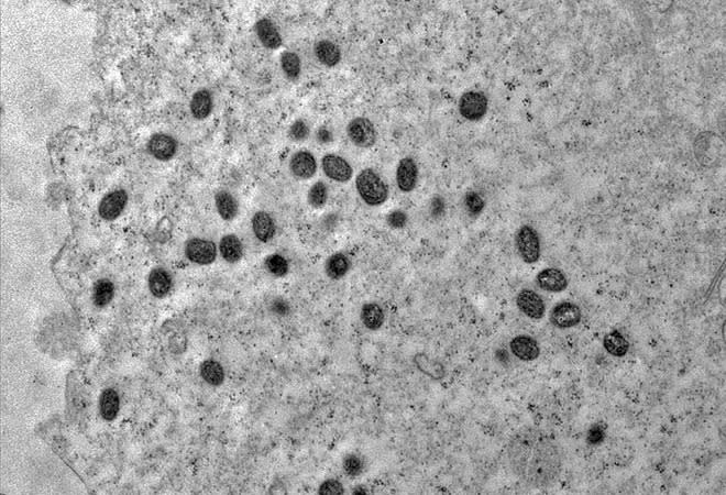 Replicação dos vírus da varíola dos macacos se intensifica e passam a controlar a célula (Imagem: Débora F. Barreto-Vieira/IOC/Fiocruz)