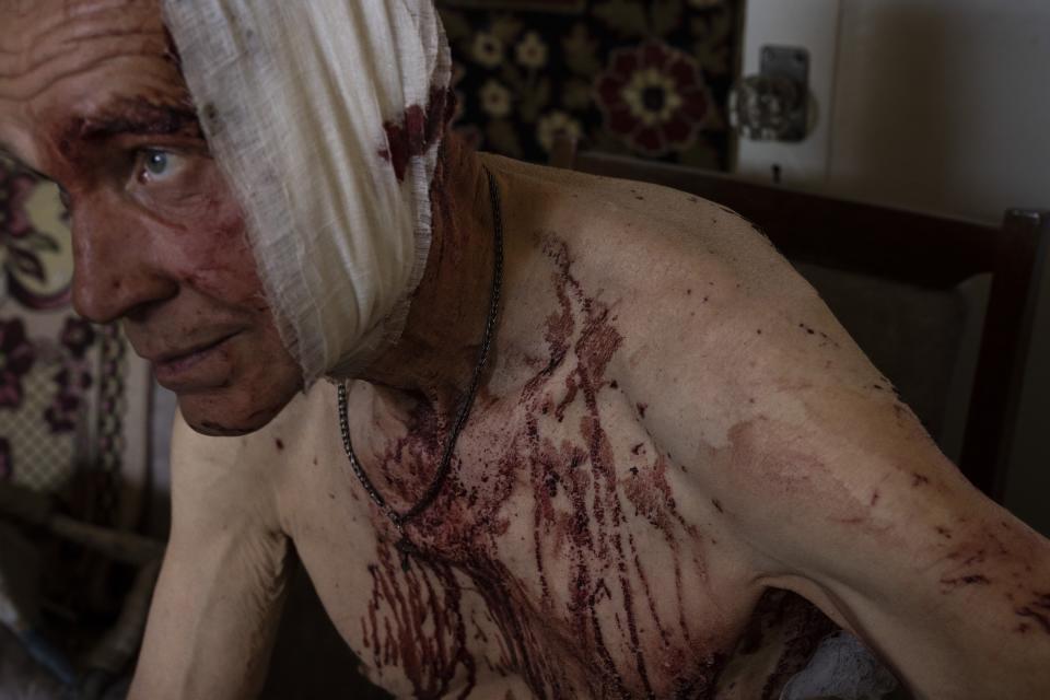 Volodymyr, injured from a strike, sits in his damaged apartment in Kramatorsk, Donetsk region, eastern Ukraine, July 7, 2022. The image was part of a series of images by Associated Press photographers that was awarded the 2023 Pulitzer Prize for Breaking News Photography. (AP Photo/Nariman El-Mofty)