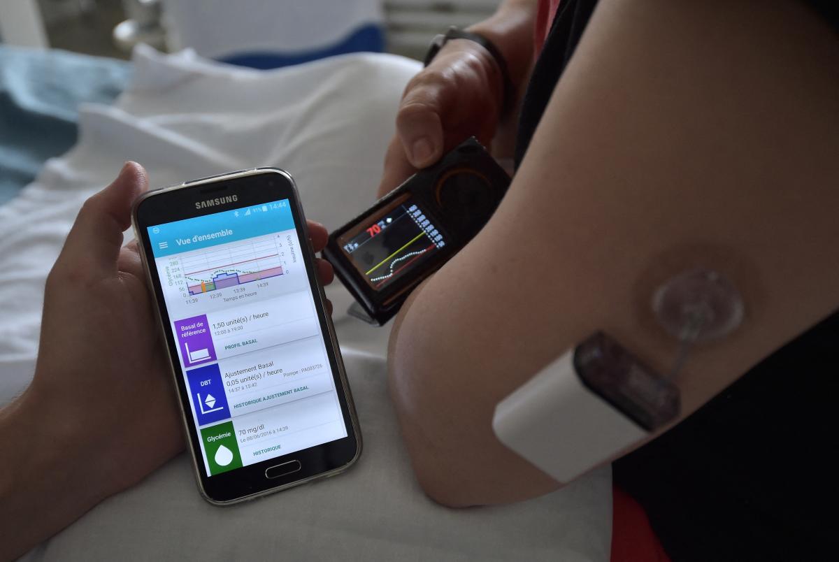 photo of England’s NHS will provide artificial pancreas to thousands of diabetes patients image