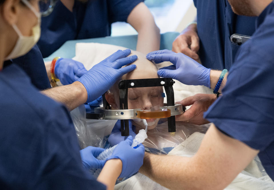 Medical staffers place a frame over Callie Weatherford's head to keep it in place during the focused ultrasound procedure. (Washington Post photo by Minh Connors)