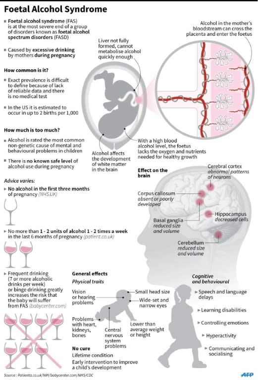 Graphic on foetal alcohol syndrome