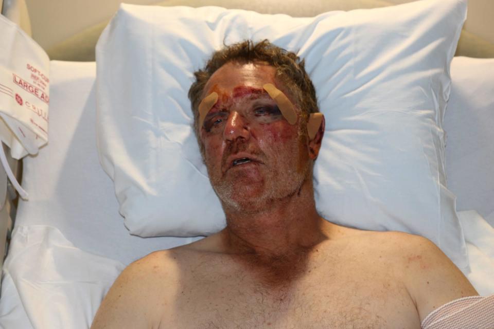 Rob Goodwin said he was able to tackle Michael Barisone to the ground. Lauren Kanarek called 911 while severely injured and gasping for air. When the first cop arrived, he saw Goodwin on top of Barisone (pictured) who was badly beaten. Barisone says he doesn't remember the shooting -only waking up handcuffed to his hospital bed. / Credit: Ed Bilinkas and Chris Deininger