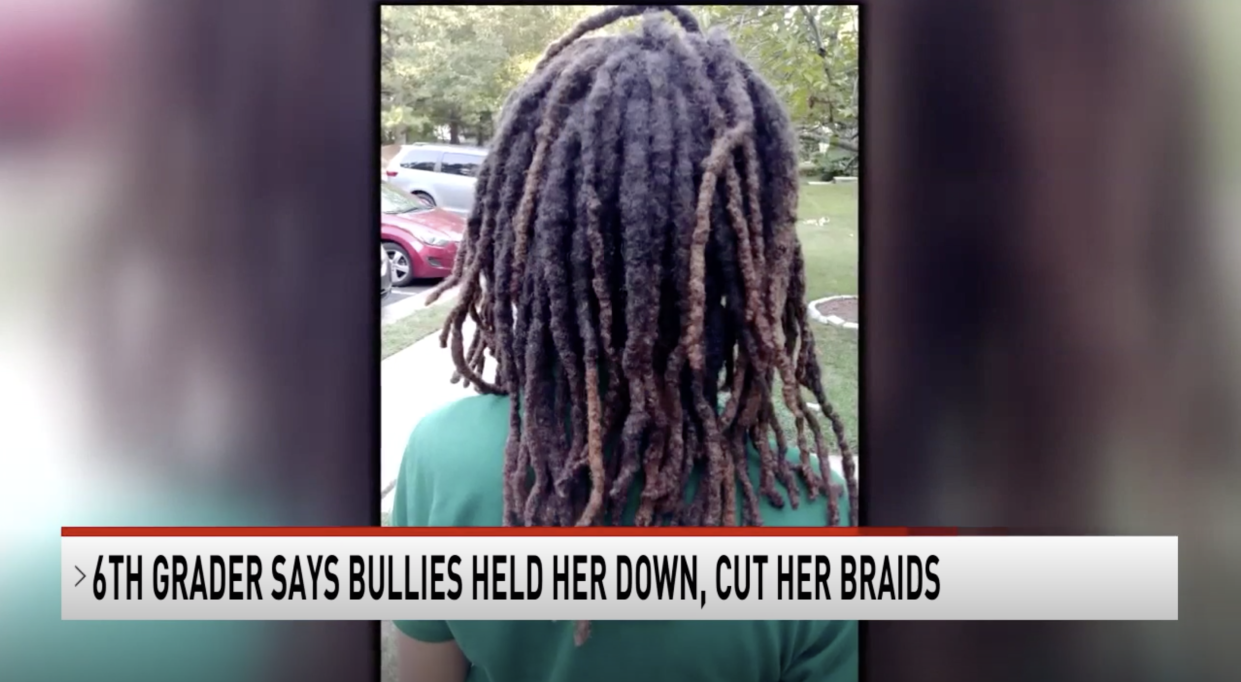 A 12-year-old girl in Virginia says three white classmates held her down and cut off her dreadlocks. (Screenshot: WJLA)