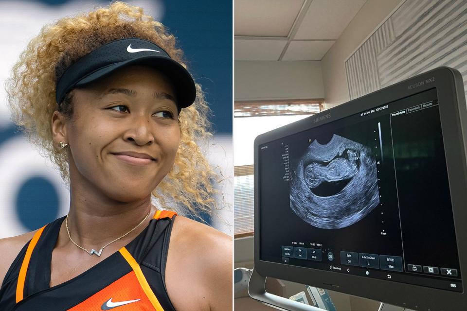 Naomi Osaka pregnant