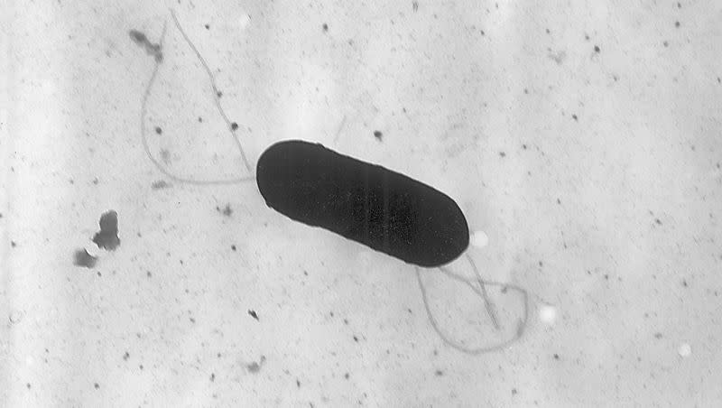 This 2002 electron microscope image made available by the Centers for Disease Control and Prevention shows a Listeria monocytogenes bacterium.