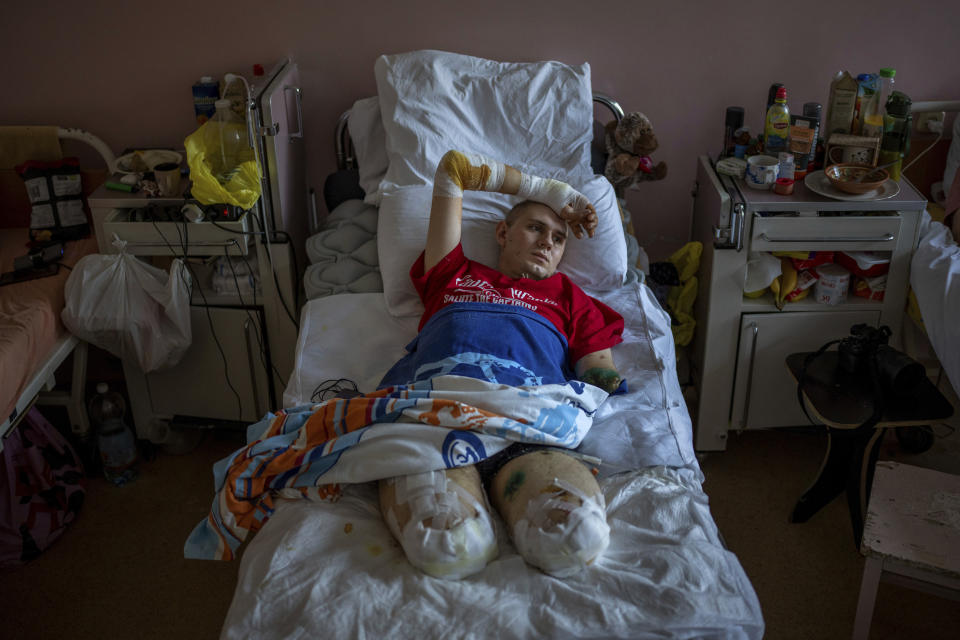 FILE- Anton Gladun, 22, lies on his bed at the Third City Hospital, in Cherkasy, Ukraine, on May 5, 2022. Gladun, a military medic deployed on the front lines in eastern Ukraine, lost both legs and his left arm in a mine explosion on March 27. Photographer Emilio Morenatti, Associated Press, was awarded a honourable mention in the Europe category of the World Press Photo Contest. (AP Photo/Emilio Morenatti, File)