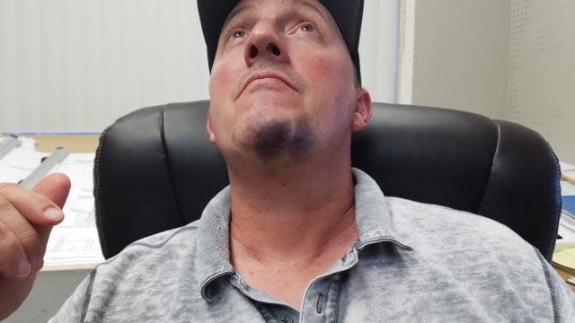 This is a photo submitted by attorneys for Sean Purdy that they say shows his swollen chin injured when Vauhxx Booker threw the first punch in a July 4, 2020 altercation at Lake Monroe.  Attorneys representing Purdy and Caroline McCord say that Booker instigated violence and threw punches first.
