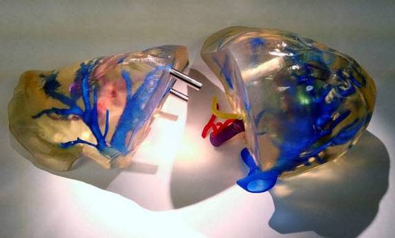 A new, anatomically accurate replica of a liver could make surgeries safer.